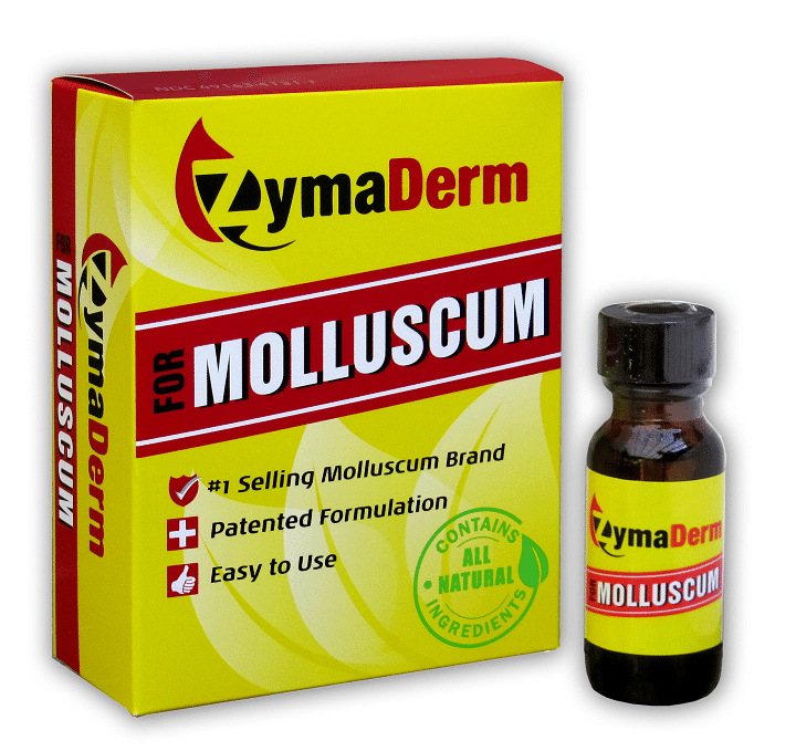Molluscum Contagiosum Treatment Options - GoodRx